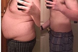 Post Weight Loss 4 post-weight-loss Clinic in Dubai