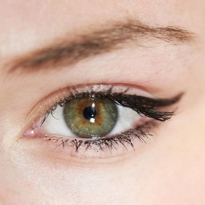 PRP For Under Eyes In Dubai: How Long Does It Last? 1 prp for under eyes in dubai