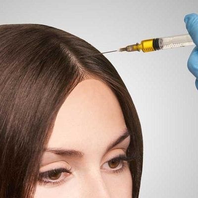 PRP Hair Treatment in Dubai