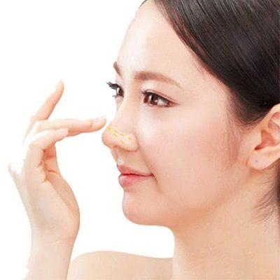 Septoplasty Cost in Dubai