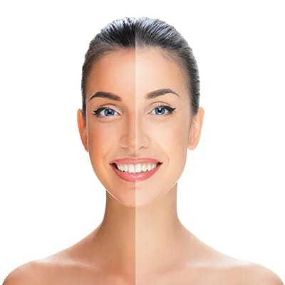 How To Remove Sun Tan From The Face? 1 sun tan removal dubai
