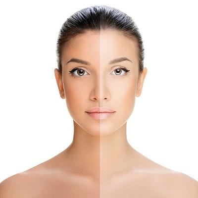 Which Treatment is Best for Removing Tan? 1 tan removal dubai