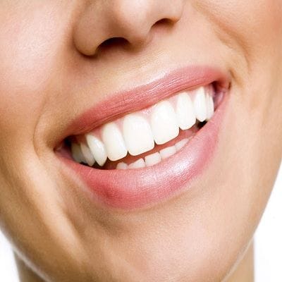 Teeth Whitening Treatment Best Prices and Offers