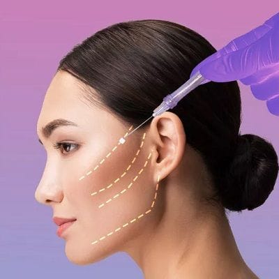 How Much Face Threads Lift Cost in Dubai and Abu Dhabi 1 thread lift cost in dubai uae