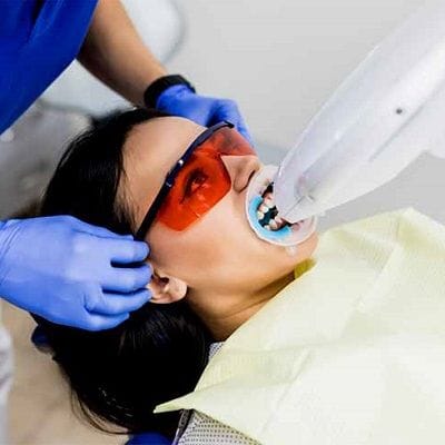 How much does it cost to get Zoom whitening in Dubai? 1 zoom teeth whitening in dubai