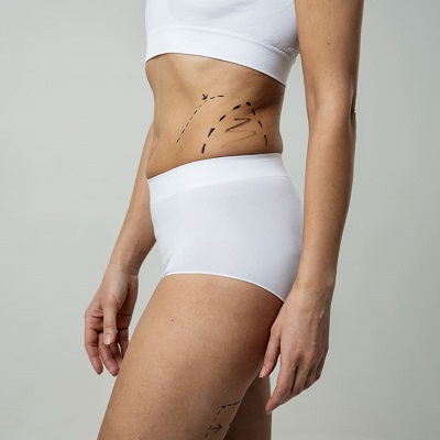 Body Jet Liposuction in Dubai