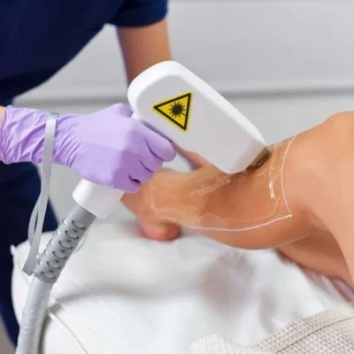 Laser Hair Removal Ajman