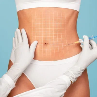 Adipose Lipolysis Injections