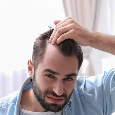 Sideburn Hair Transplant