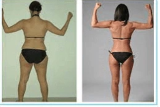 Proellixe Vibration Therapy 6 Before & After Proellixe Vibration Therapy