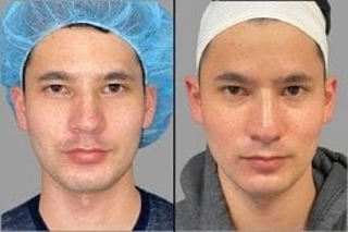 Enlighten Pico Genesis 6 Enlighten Pico Genesis Before and After