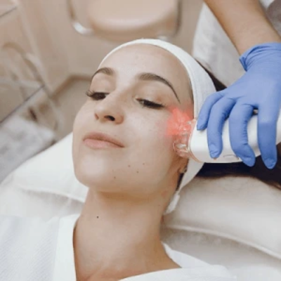 Fotona 4D for Facelift in Dubai