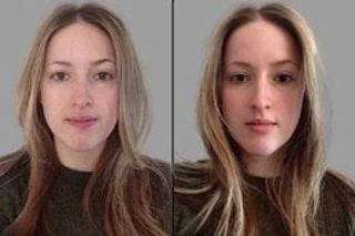 LED Light Therapy Before & After