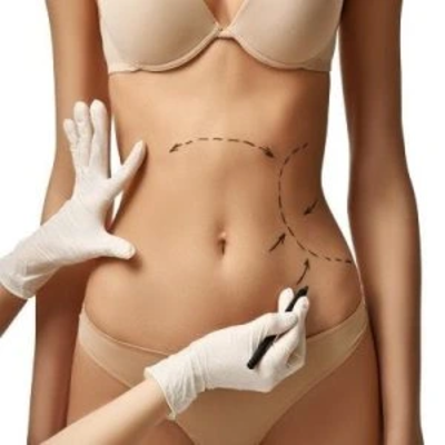 Liposonix Treatment in Dubai