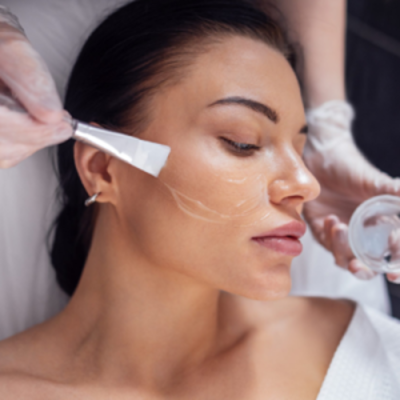 Chemical Peel Treatment in Dubai
