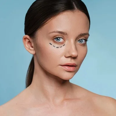 How Long Does Dark Circle Treatment Last