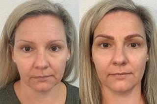 Semi Permanent Makeup 6 Semi Permanent Makeup Treatment Before & After