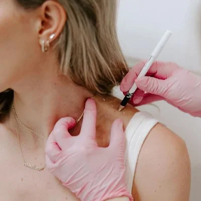 Botox for Shoulders