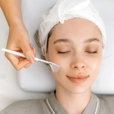 Chemical Peels in Al Barsha