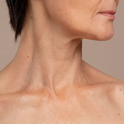 Decolletage Anti-Aging