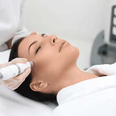 Pico Laser Treatment