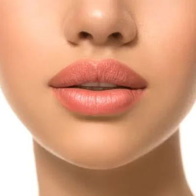Lip Augmentation in dubai
